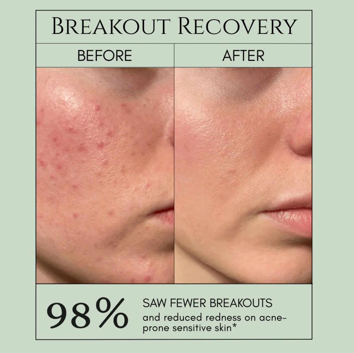 Holy Basil Bubble Deep Mask