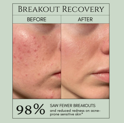 Holy Basil Bubble Deep Mask