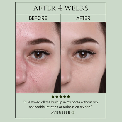 Holy Basil Bubble Deep Mask